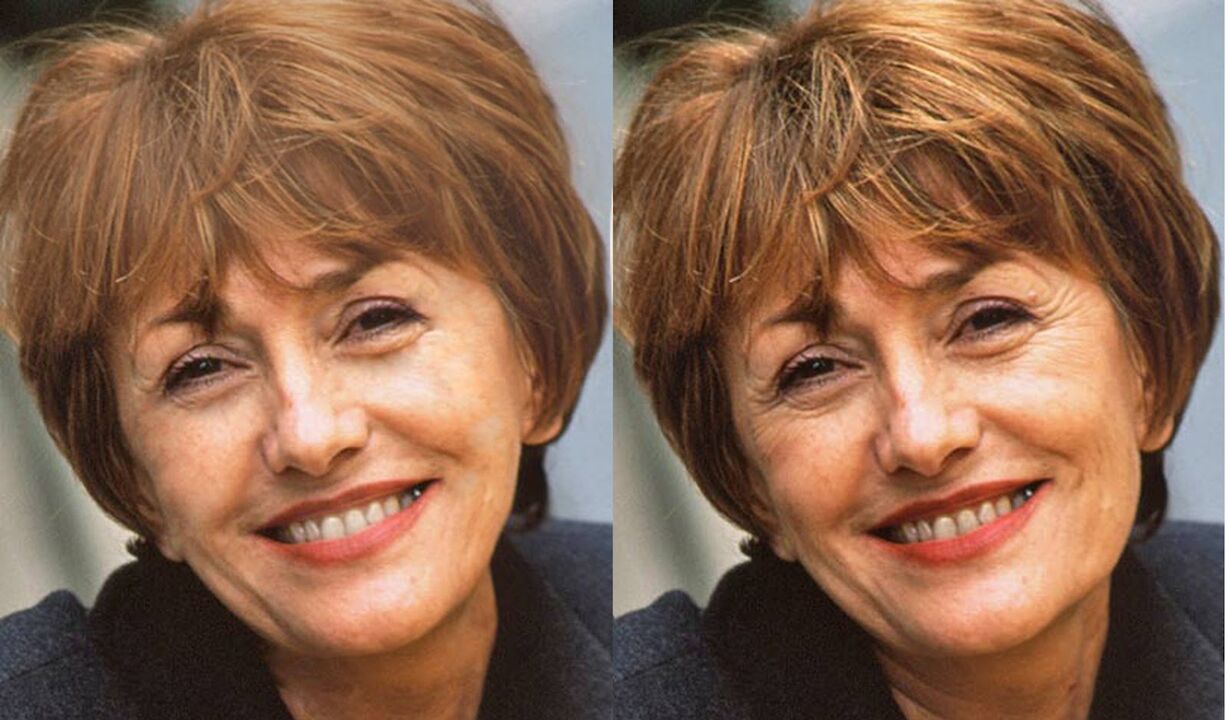 fotografia tváre pred a po kontúrovaní